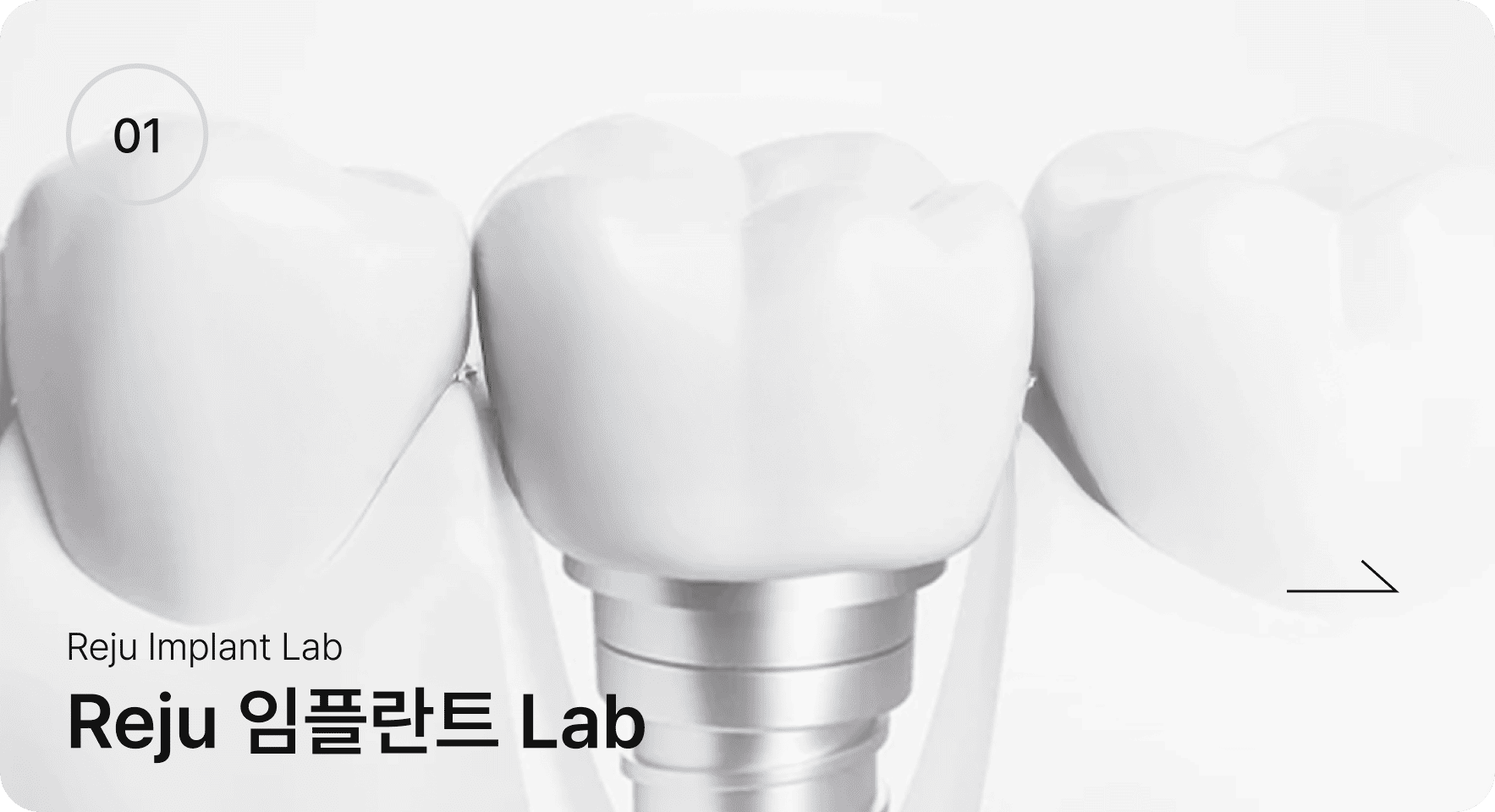 Reju 임플란트 Lab